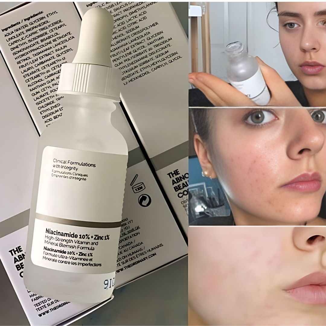 Niacinamide Serum-VisageGlint-Skin-care-product-in-Pakistan